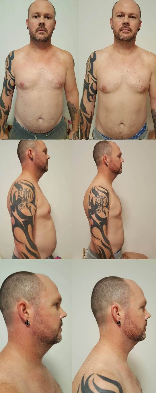 Dan Munros Gutless Program Before and After Pictures