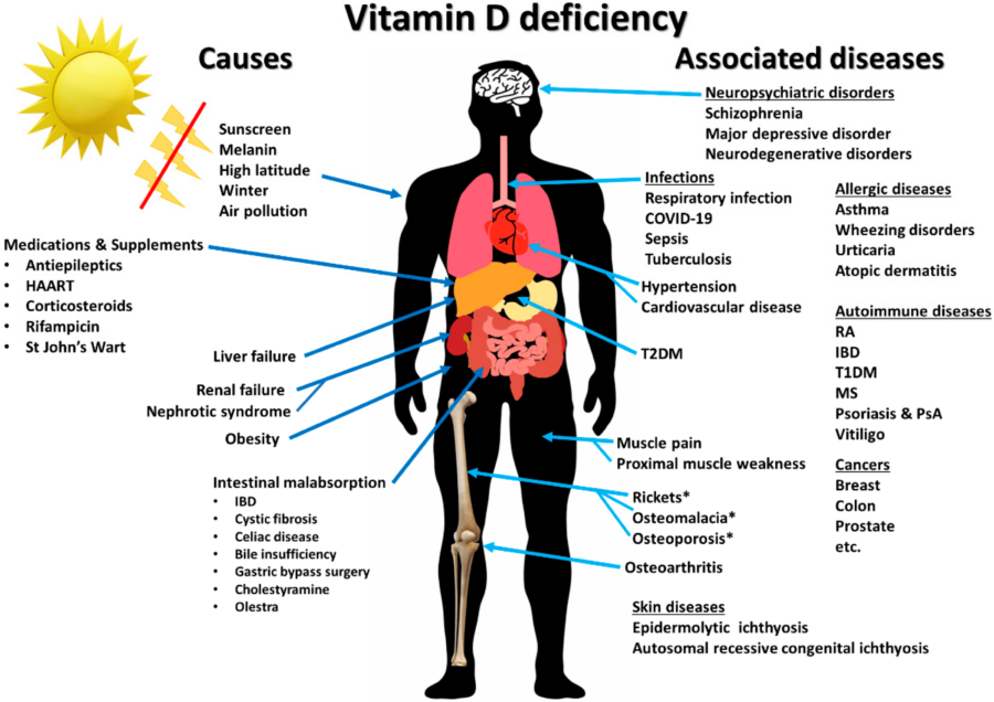 Vitamin d defficiecny causes and associated diseases